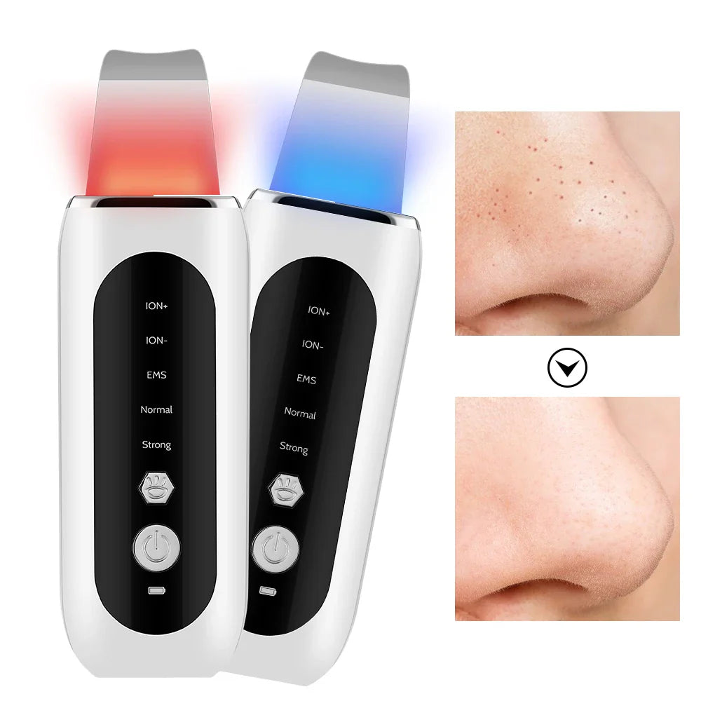 Radiantglow - Gesichtsporenreiniger und Blackhead -Entferner 0
