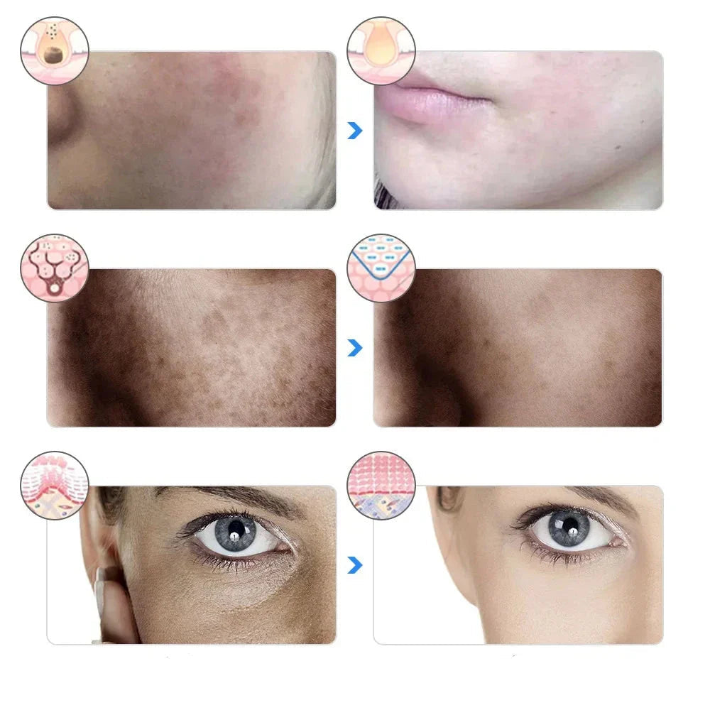 Altersglühen - 7 -Farben -LED -Therapiemaske für Gesichtsaufhebung und Aufhellung 4