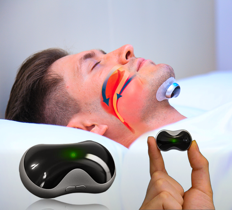 Anti-Rucing-Gerät mit Elektrostimulationstechnologie-Bocchino bequeme Anti-Krevation für eine bessere Schlafqualität 0