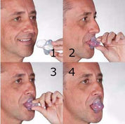 Apnoe -Zungenstabilisierungsvorrichtung 2