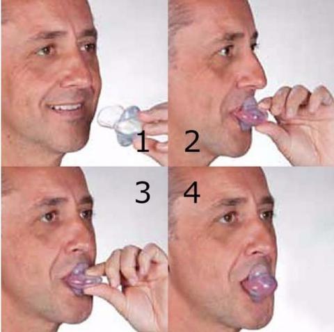 Apnoe -Zungenstabilisierungsvorrichtung 2