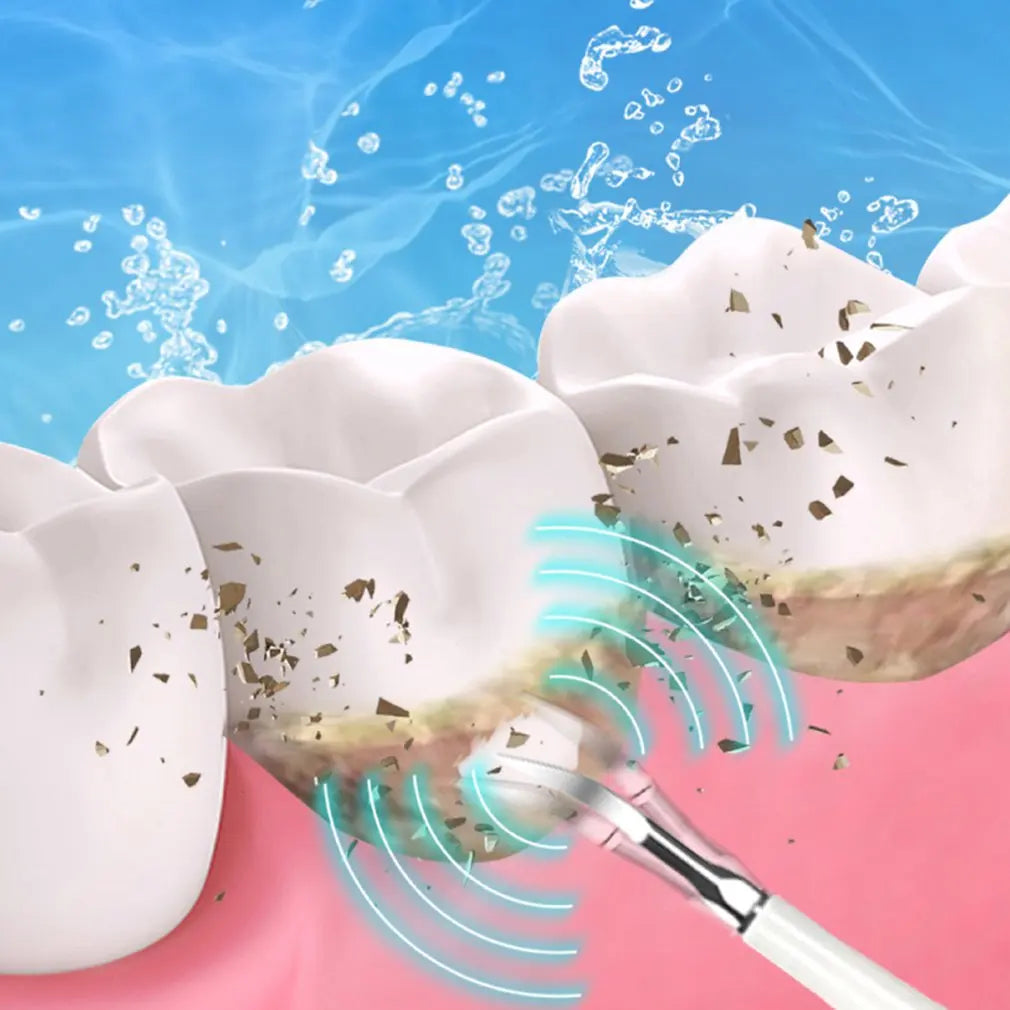 Sparksonic - Sonic Dental Cleaner & Whitening Irrigator 2